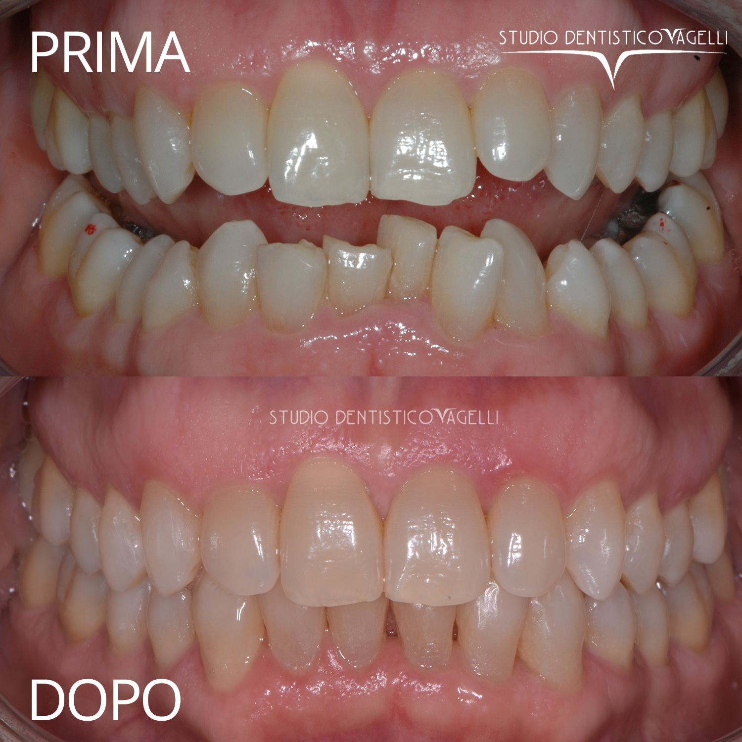 vagelli-prima-dopo-6