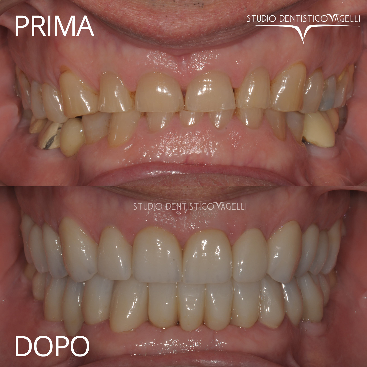 vagelli-prima-dopo-7